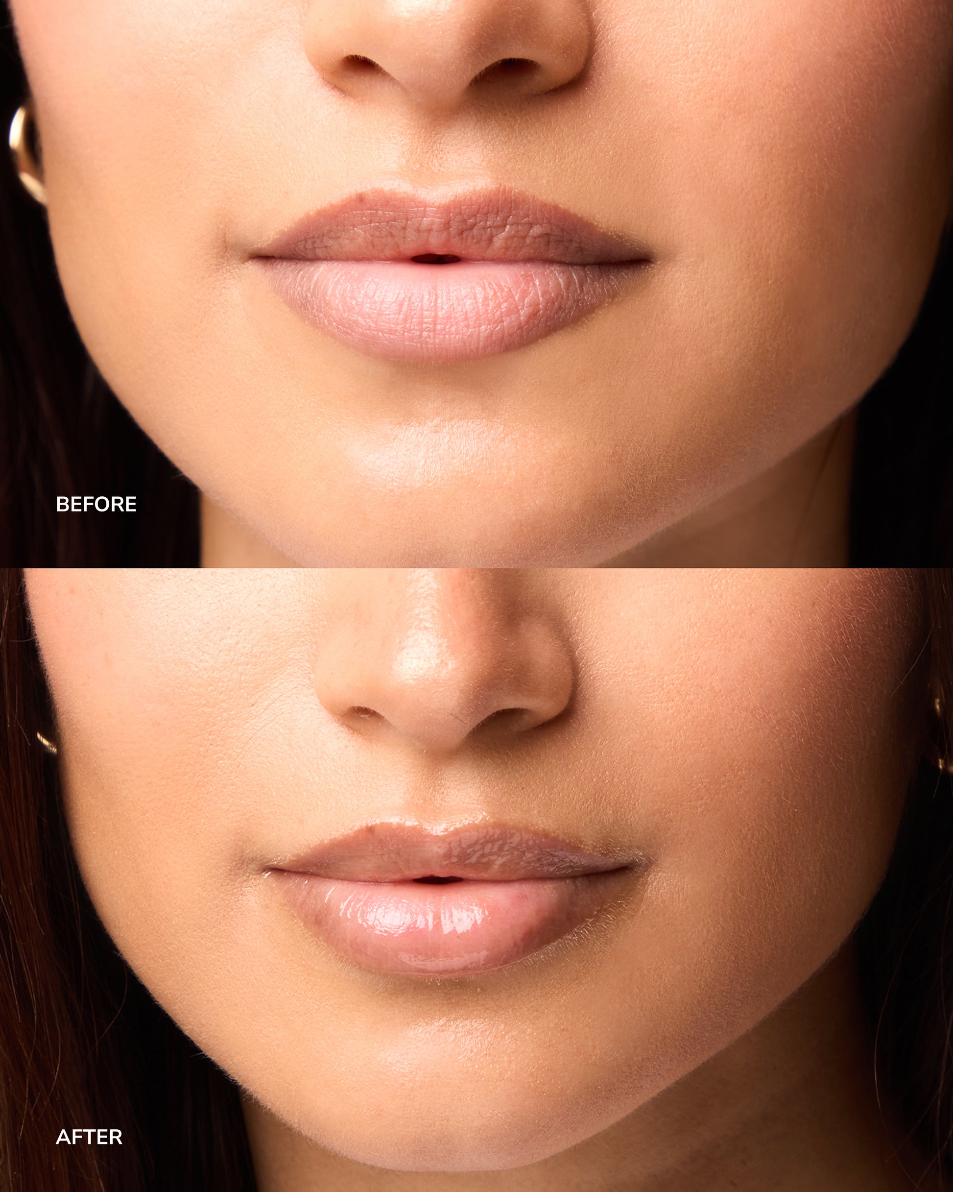 Lip Treatment